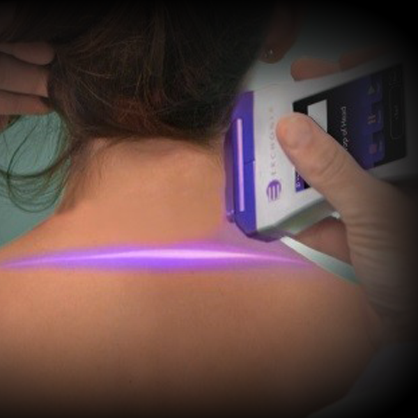 Low Level Cold Laser Therapy