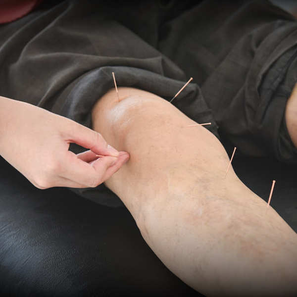 Dry Needle Therapy Conditions